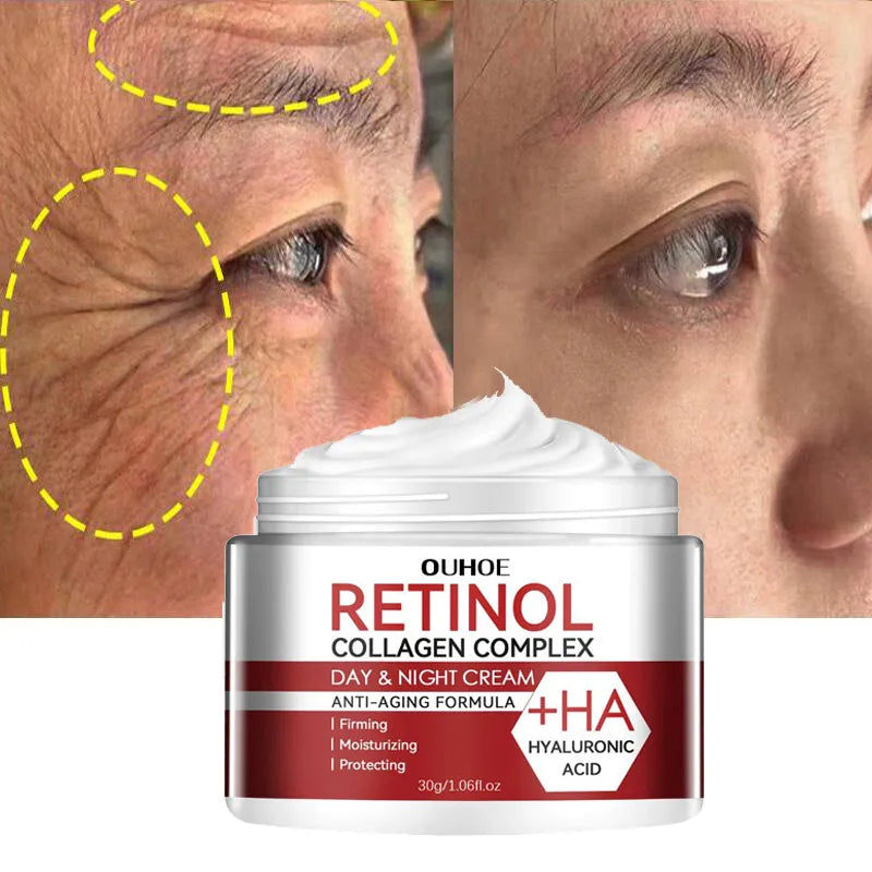 Retinol Wrinkle Removing Cream
