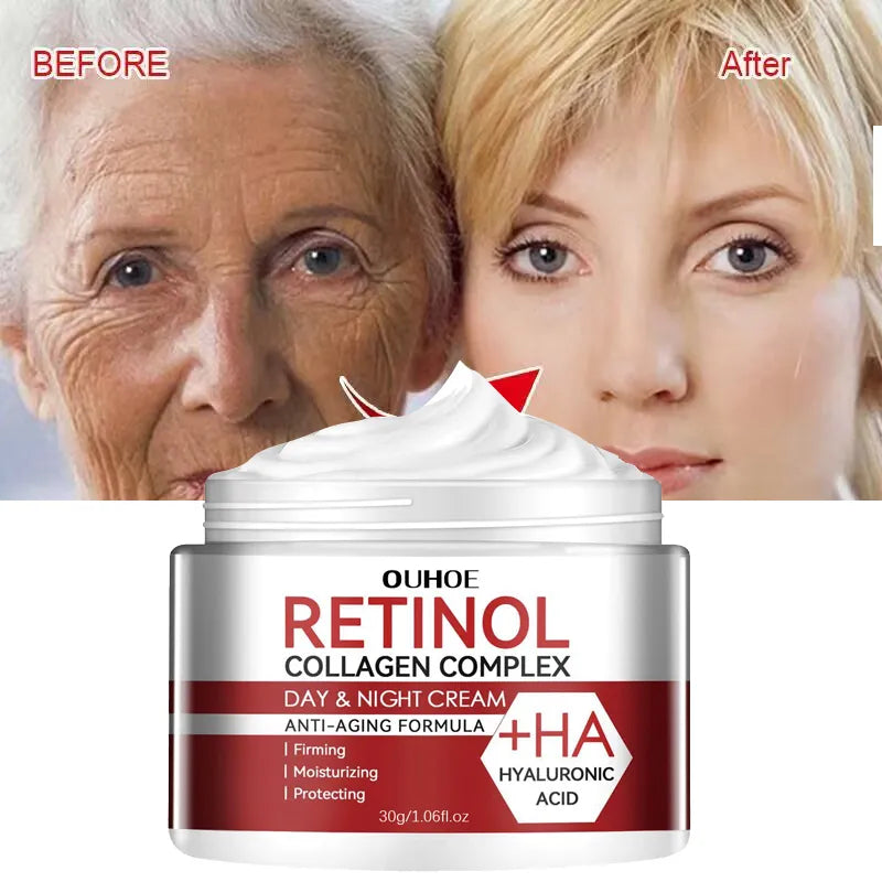 Retinol Wrinkle Removing Cream